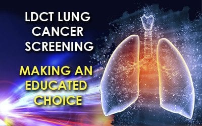LDCT Lung Cancer Screening: Making an Educated Choice