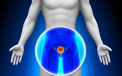 Prostate Cancer Imaging Pathways Evolve with PSMA PET/CT Technology